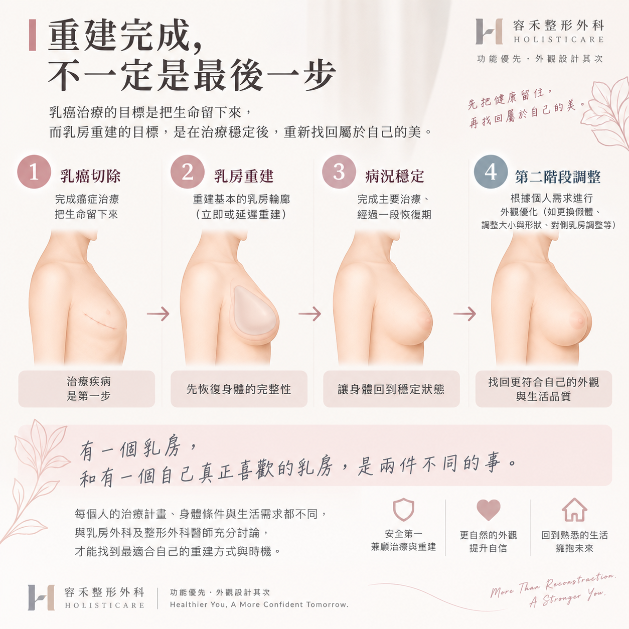 乳癌治療與乳房重建穩定後進行第二階段胸型調整